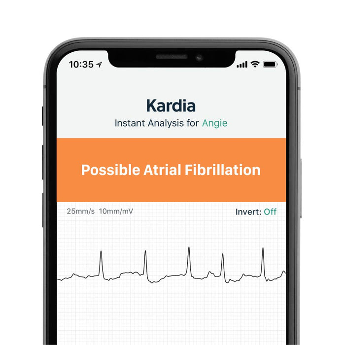 AliveCor's KardiaMobile 6L | FDA and CE Approved Personal ECG Device for iOS and Android | Wireless 6-Lead ECG | Detects AFib, Bradycardia, Tachycardia and Normal Heart Rhythm in 30 Seconds